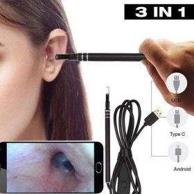 Digital Led Otoscope Ear Camera Scope Earwax Removal Kit Ear Wax Cleaning